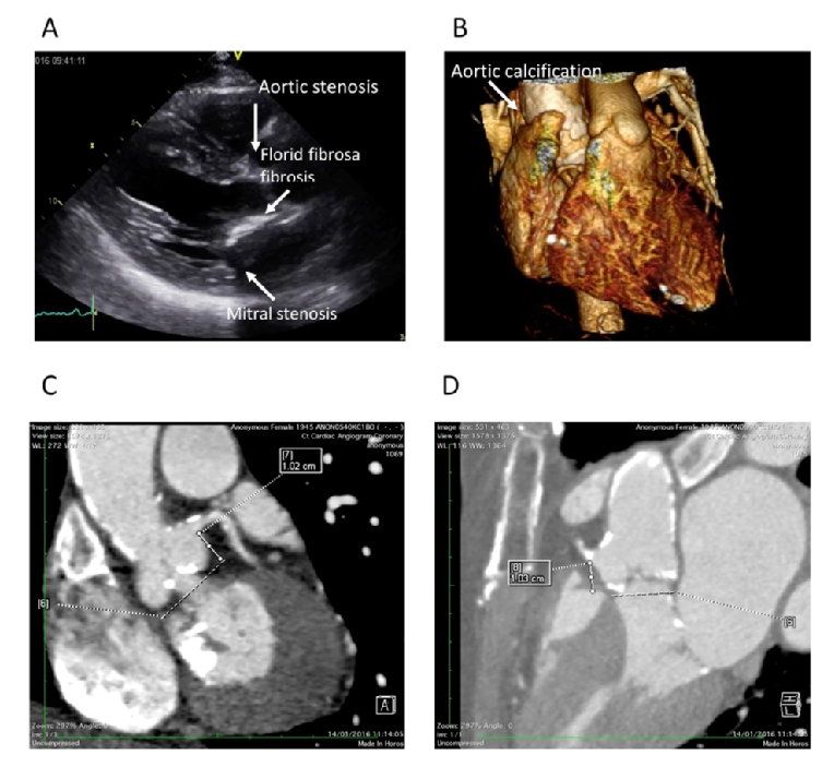 15_27_Figure 2_escardio-hPhotoLarge.jpg