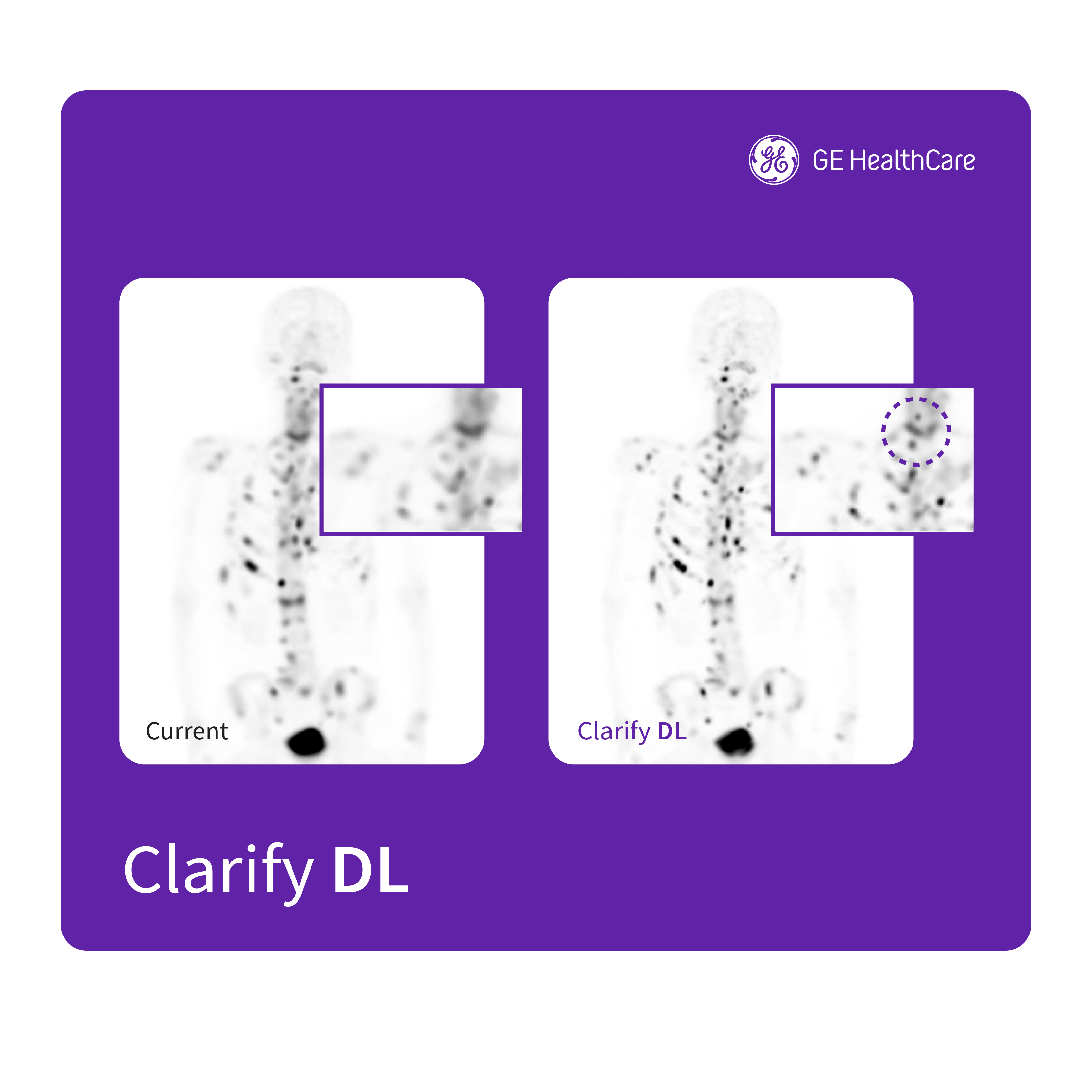 Clarify DL 2 (2).png