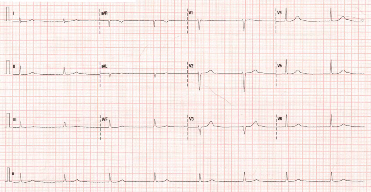 Picture2 Clinical case CCVG insights Vol13_escardio-hPhotoLarge.png