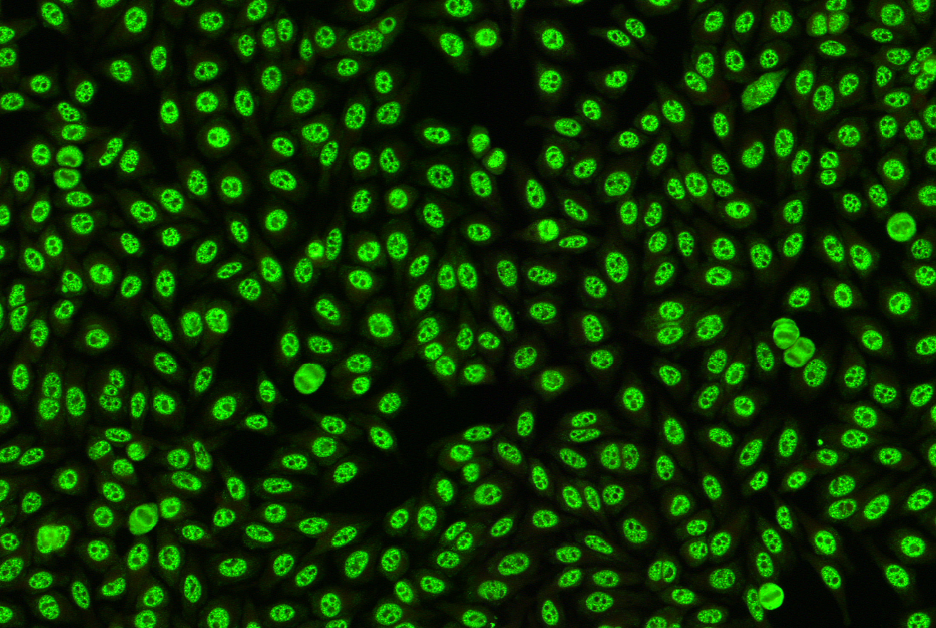 Indirect Immunofluorescence Assays (IFA)