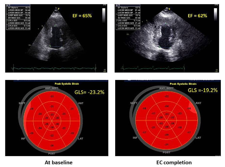 166_Galderisi_Figure 1_What is the best imaging tool in cardio-oncology.jpg