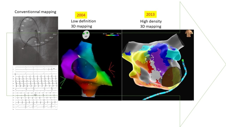 286_Sebag_Figure 1_Cardiac electrophysiology evolution of the technique over the last decade.jpg