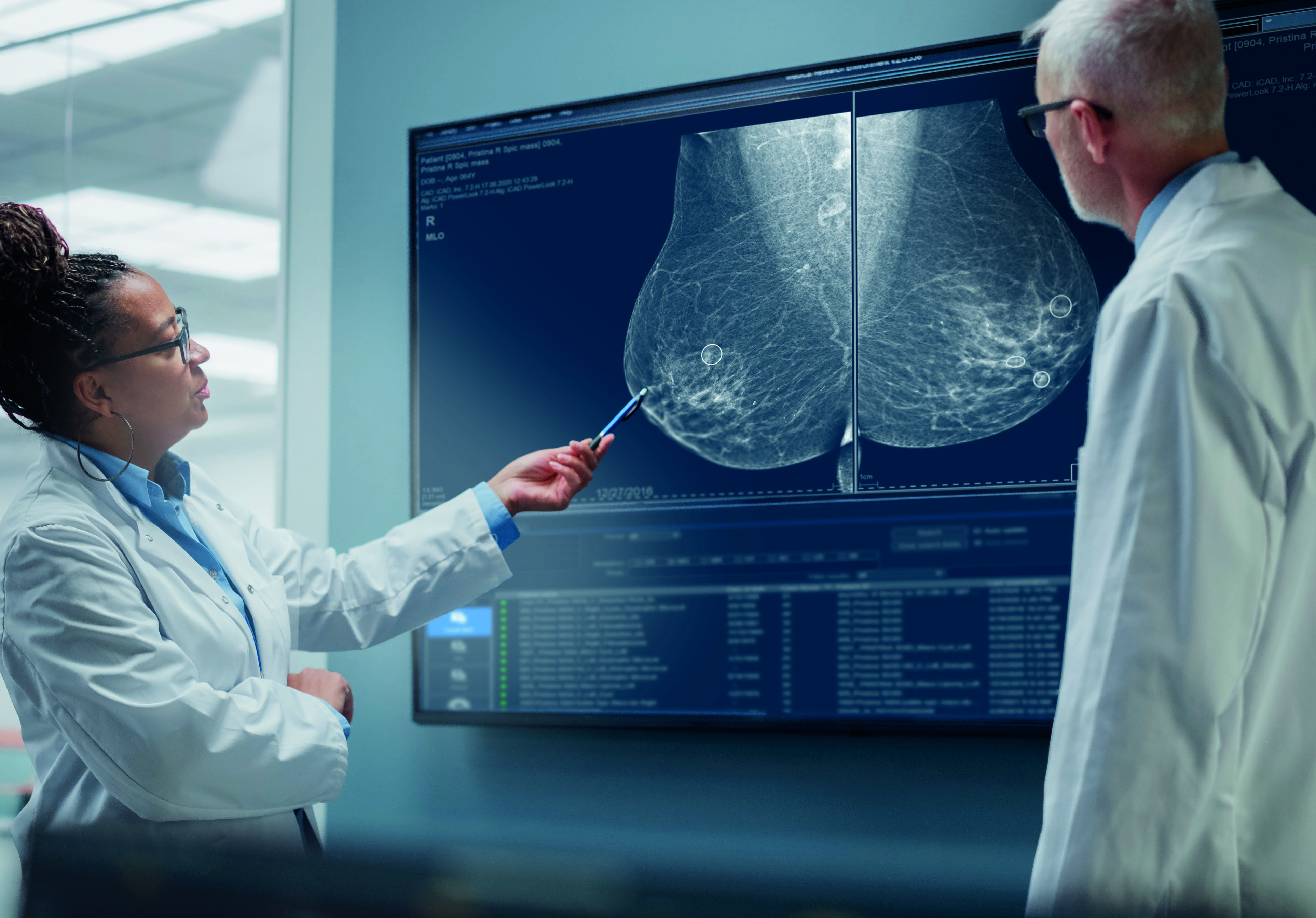 MyBreastAI Suite, un ulteriore passo avanti nell’ottimizzazione della diagnostica mammografica