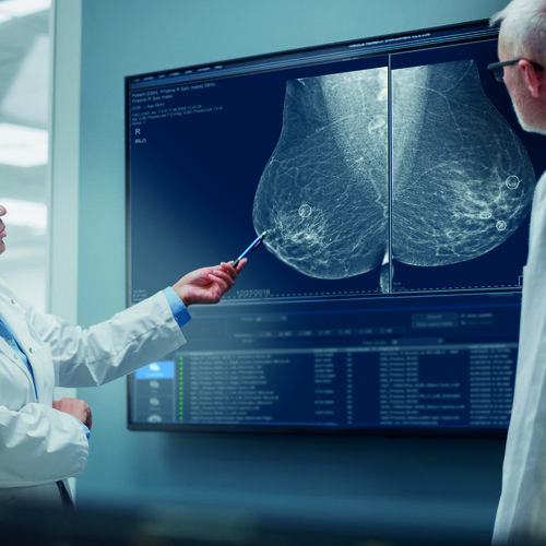 MyBreastAI Suite, un ulteriore passo avanti nell’ottimizzazione della diagnostica mammografica