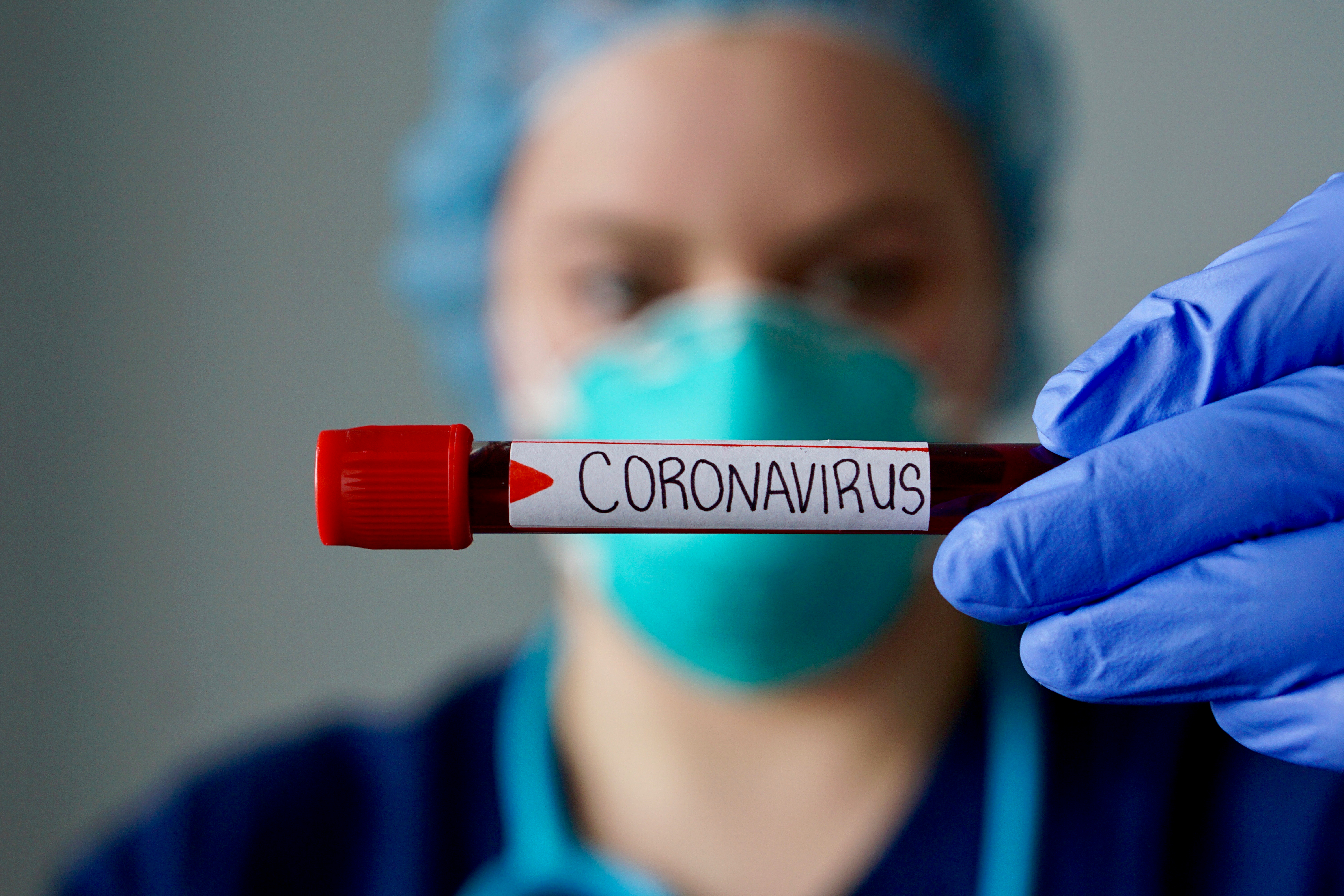 Tetap Tenang dan Waspada atas Outbreak Virus Corona di China