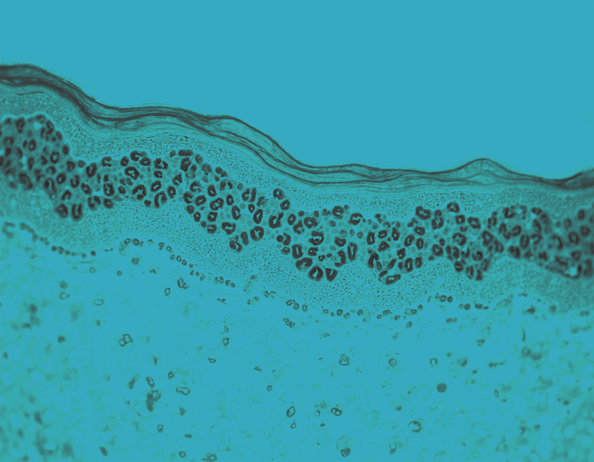 Human skin tissue with cells under miscroscope