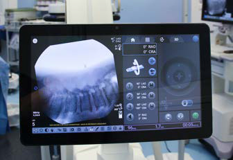 Immagine fluoroscopica 2D della colonna lombare in vista laterale per controllare il livello della colonna vertebrale.jpg