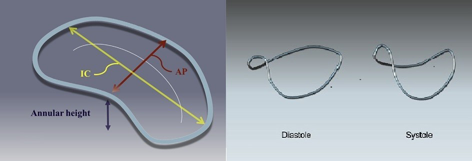 145_Pressman_Figure1-Aetiology and epidemiology of mitral stenosis.jpg