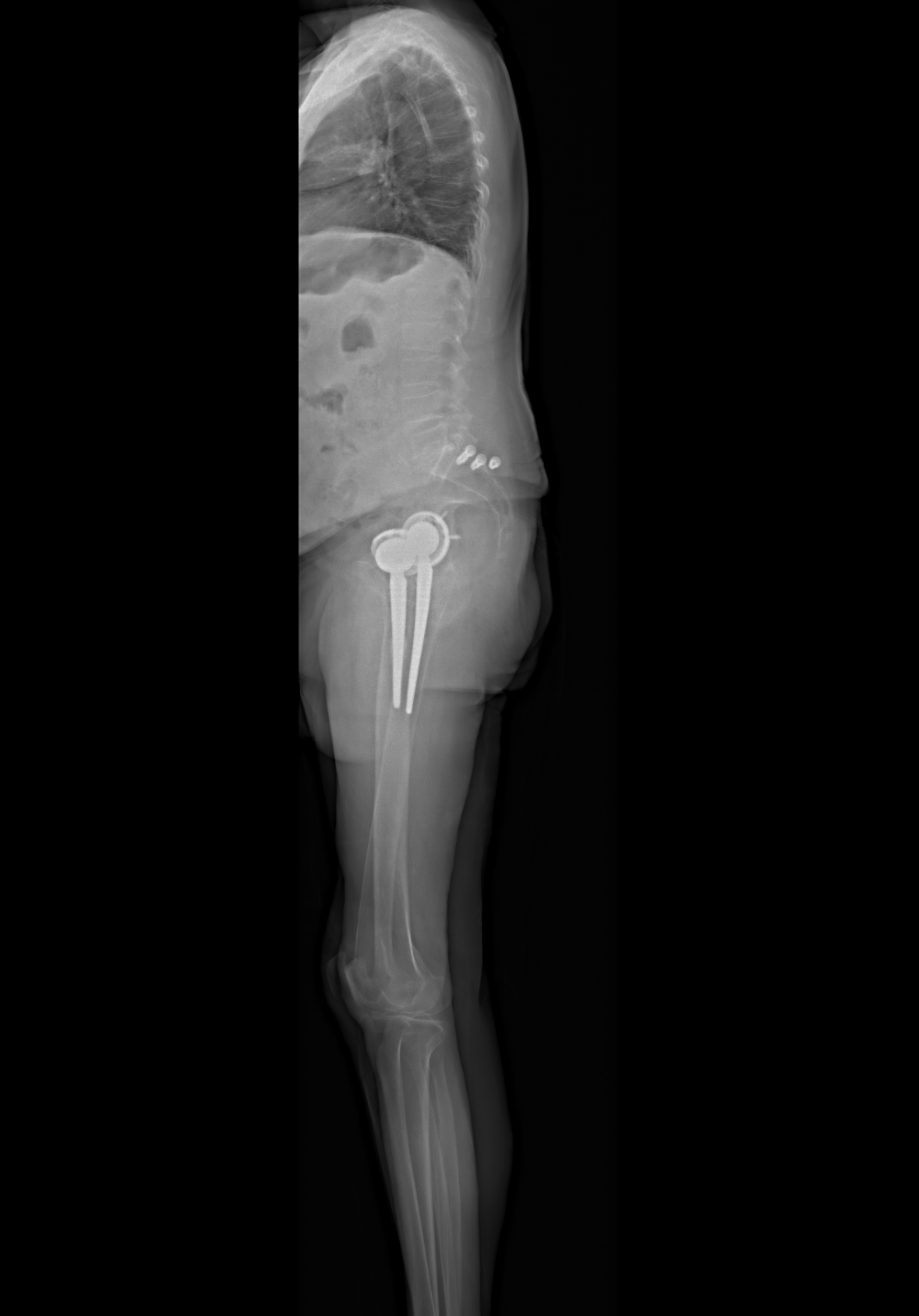 Patient image of: James Preston