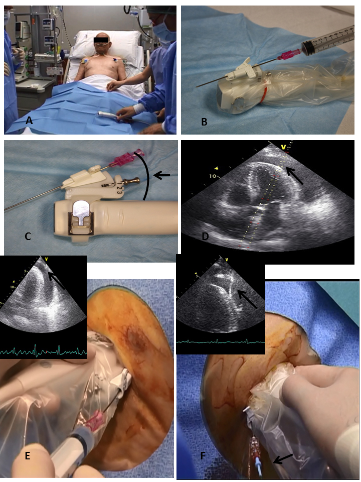 110_DeCarlini_Figure 2.jpg