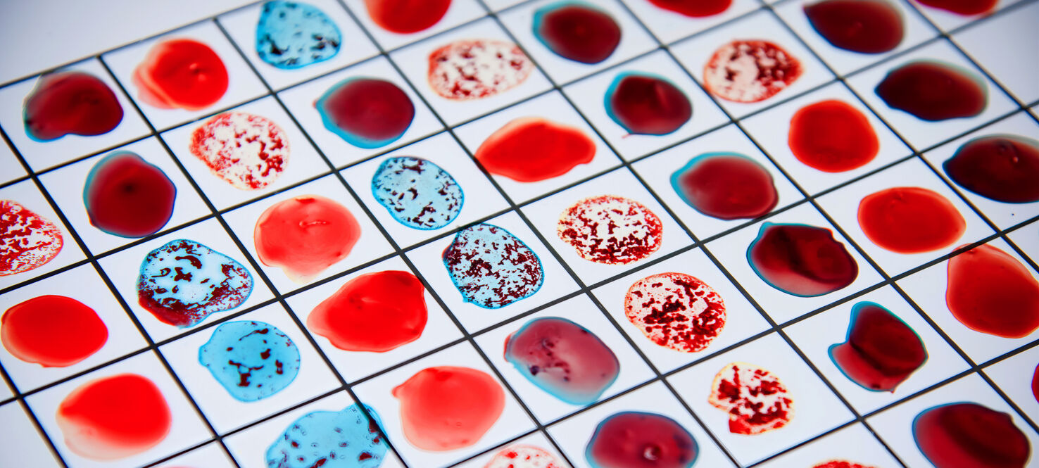 What Determines Your Blood Type