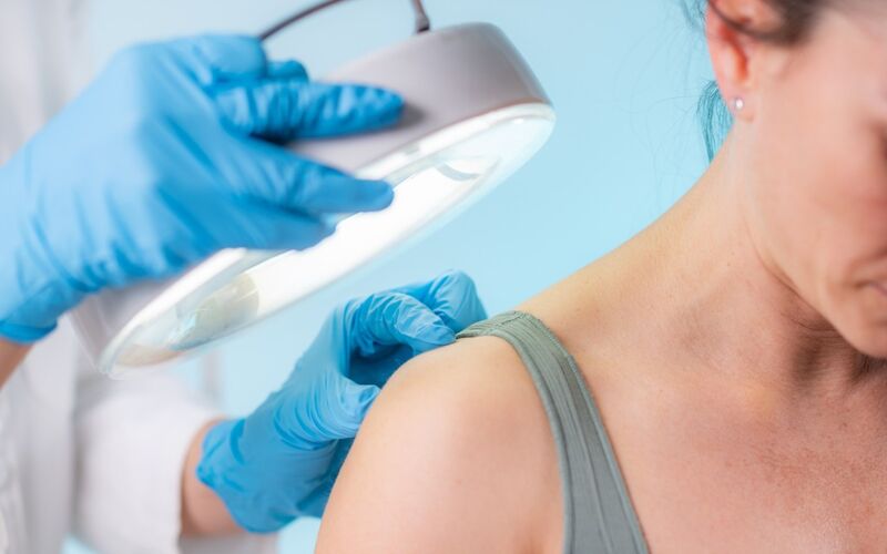 AI opens the door to personalized melanoma treatments 