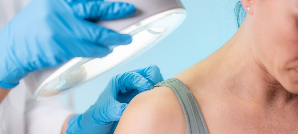 AI opens the door to personalized melanoma treatments 