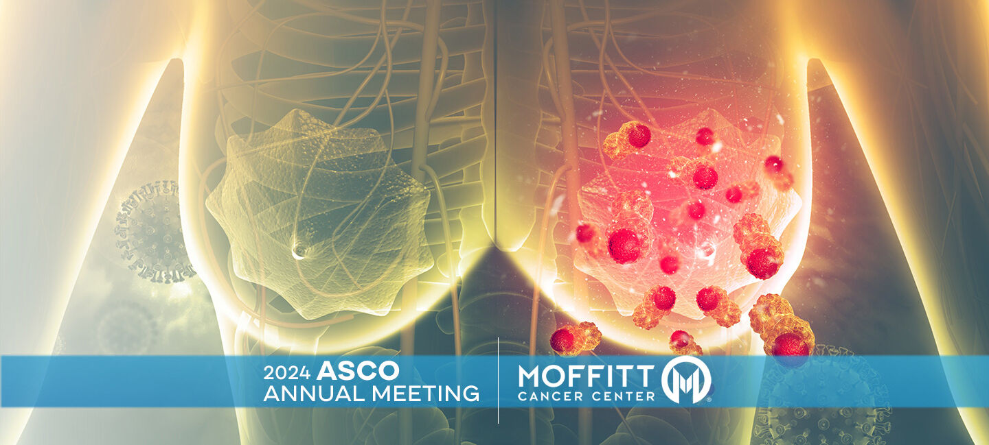 graphic image of breast with cancerous cells