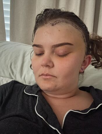 Adelie Landis, Meningioma Patient, October 2026 Feature