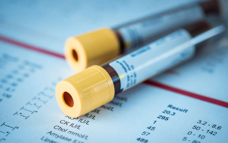 Blood test tubes