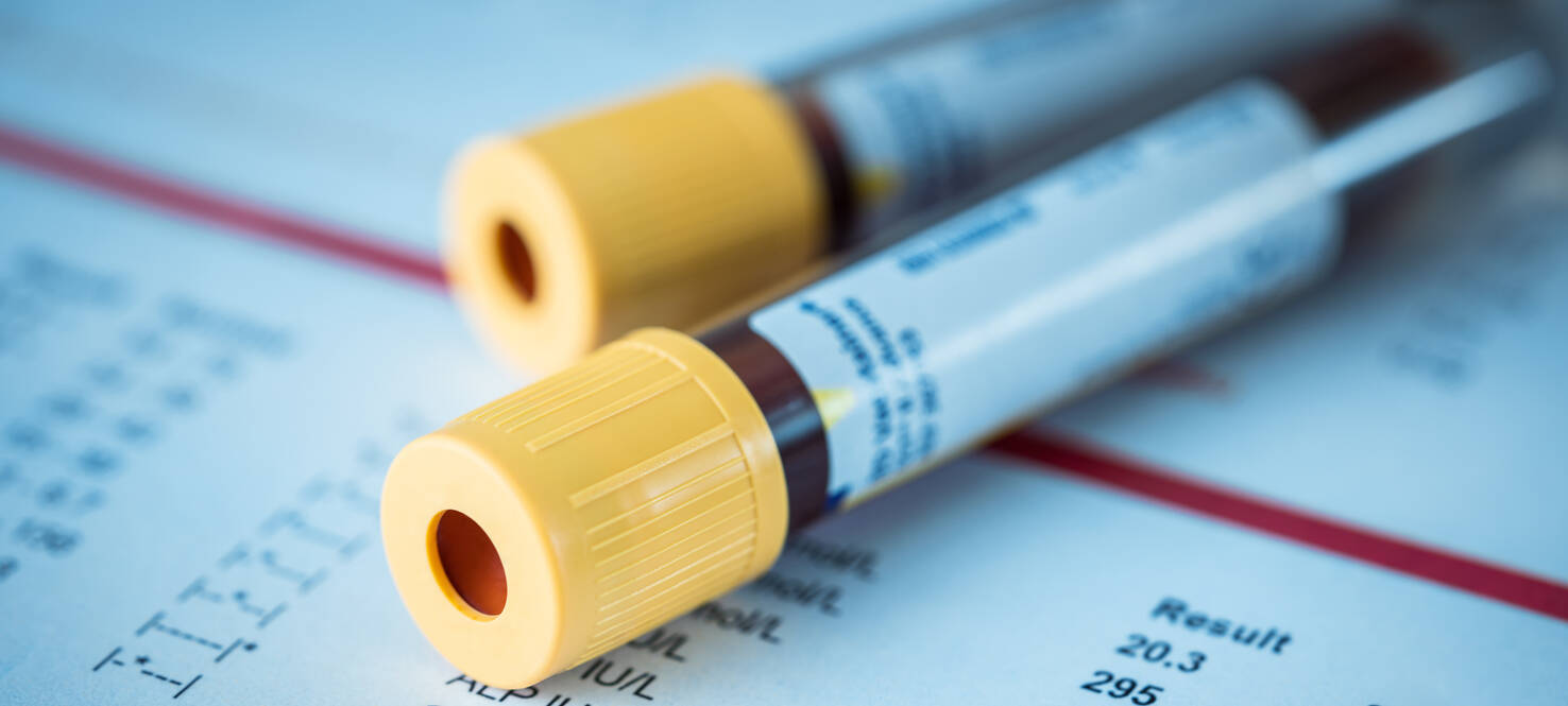 Blood test tubes
