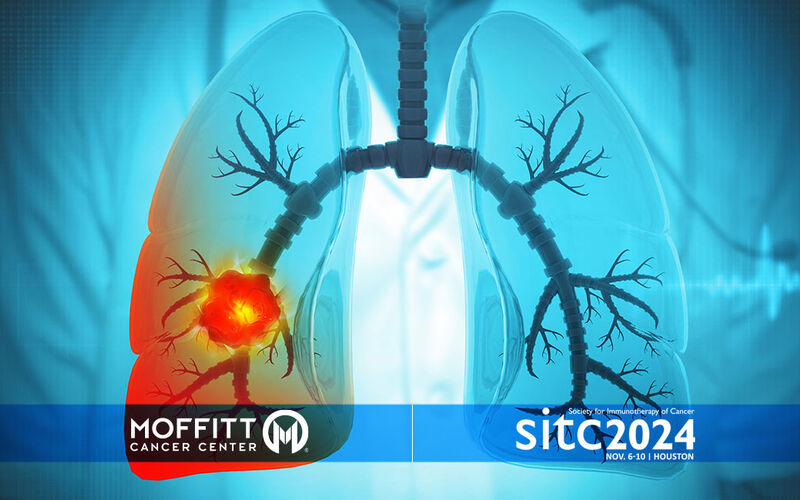 graphic of lungs with a tumor in one