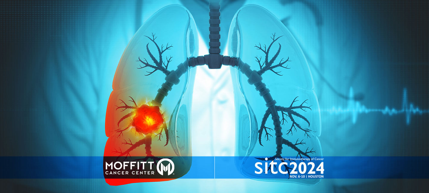 graphic of lungs with a tumor in one