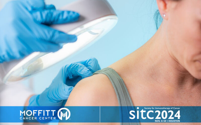 AI opens the door to personalized melanoma treatments