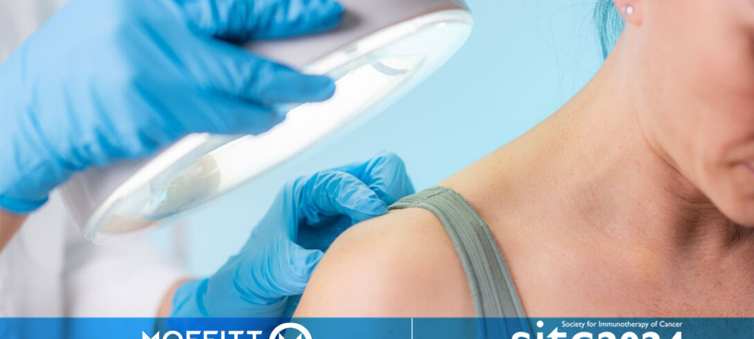 AI opens the door to personalized melanoma treatments