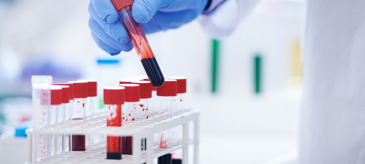 Vials of blood for blood testing