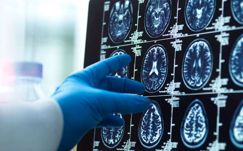 Brain scan image with a doctor's hand, representing medical diagnosis and research