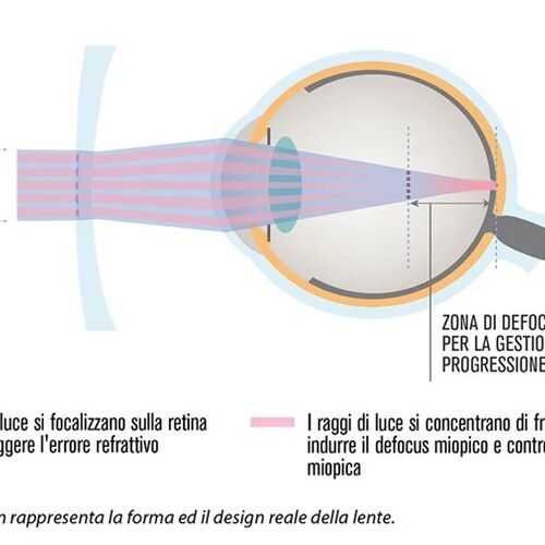 HOYA MiYOSMART grafica italiana