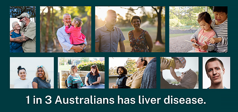 1 in 3 Australians have liver disease
