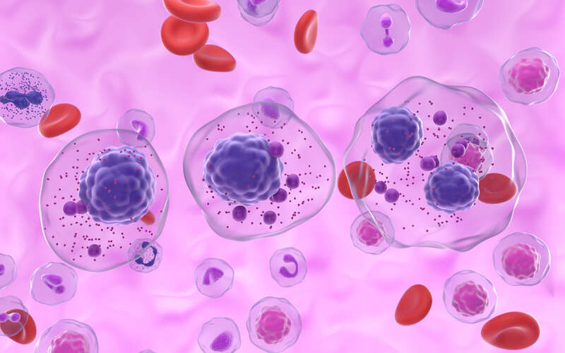 graphical image of multiple myeloma cells in the blood stream