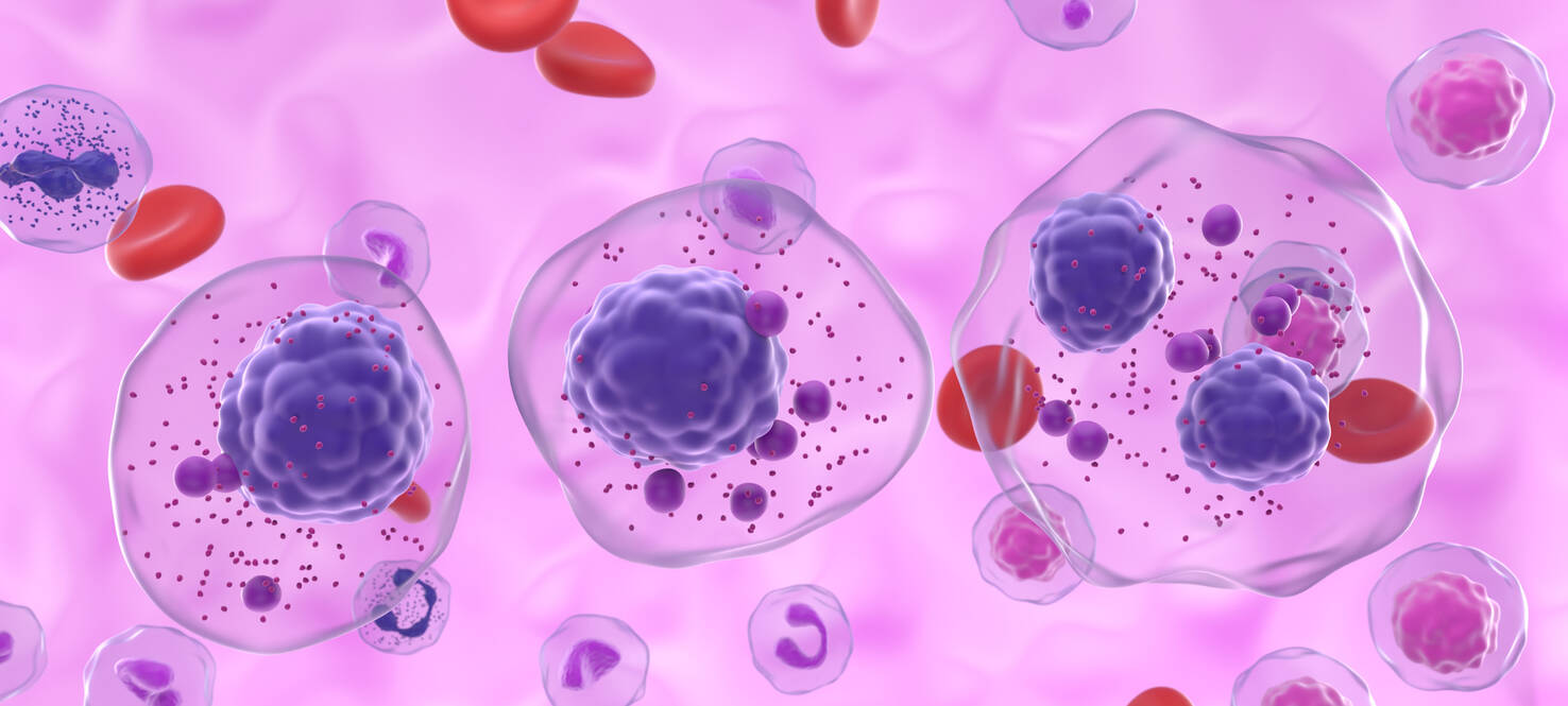 graphical image of multiple myeloma cells in the blood stream